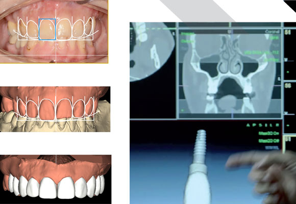 La odontología emocional se sirve de la última tecnología para crear sonrisas 'A la carta'