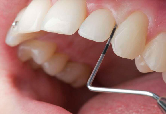 El mal cuidado de las encías puede llevarnos a perder dientes