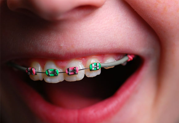dentistasniños3