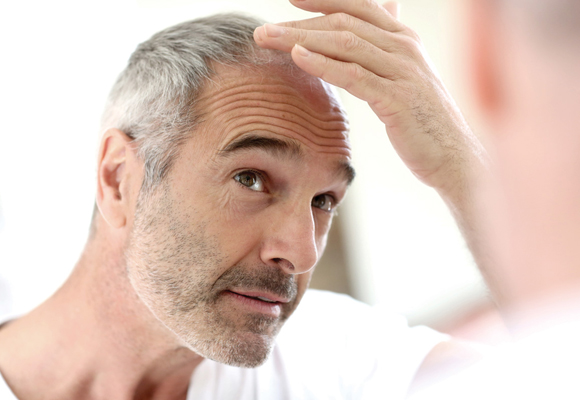 La prevención es fundamental para evitar la caída del pelo
